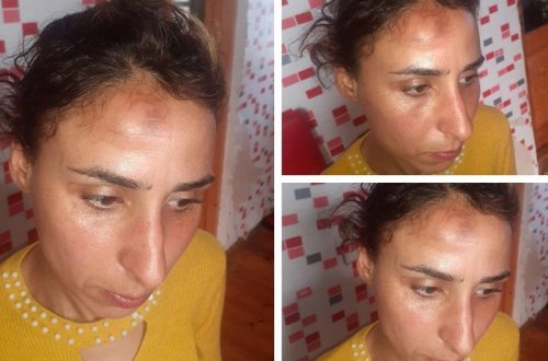 Avtobusda dava düşdü, tibb bacısı qadını döydü