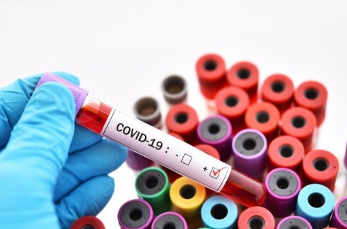 ÜST: “Dünya əhalisinin təxminən üçdə biri koronavirusa qarşı peyvənd olunmayıb”