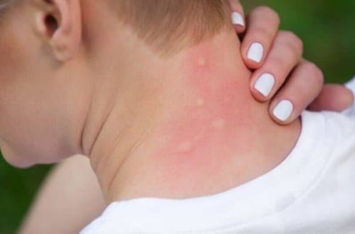 Ağcaqanadlar vasitəsilə yayılan yeni virus - Bu ölkə üçün xəbərdarlıq edildi