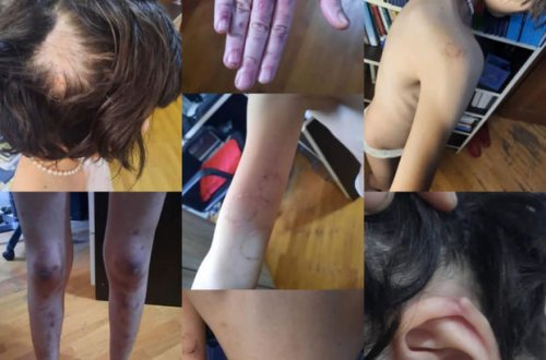 DİN-dən hamilə qadının və 13 yaşlı qızın döyülməsinə REAKSİYA - FOTO