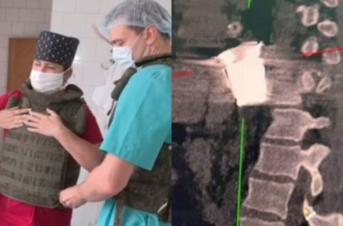 Rusiyada hərbçinin sinəsindən partlamamış sursat çıxarıldı - VİDEO