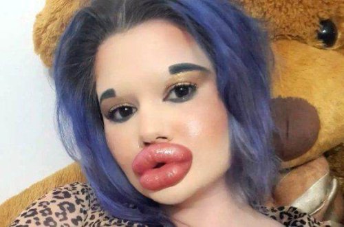 Dünyanın ən böyük dodaqları olan qadın rekorda cəhd edəcək