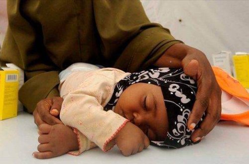 Cənubi Afrikada qızılca epidemiyasına yoluxanların sayı 35-ə yüksəlib