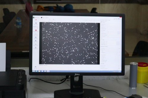 Azərbaycanda ilk dəfə düyələrə uğurlu embrion transferi həyata keçirilib