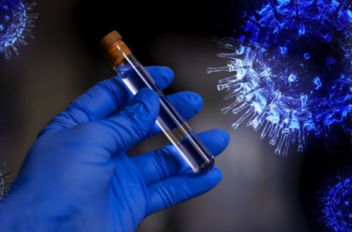 COVID-19 üçün yeni biomarker tapıldı