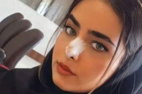 Təbrizdə gənc tələbə qız güllələnərək öldürüldü - FOTO