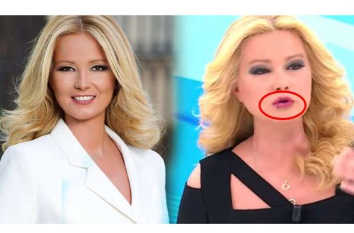 İti aparıcını xəstəxanalıq etdi