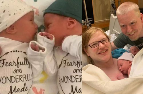 Yeni dünya rekordu: 31 yaşlı əkizlər dünyaya gəldi - FOTO