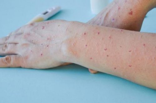 Meymunçiçəyi bundan sonra belə adlanacaq