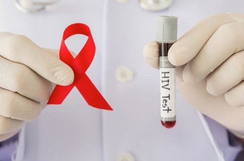 Azərbaycanda İİV xəstəliyinin yayılmasının lokallaşdırılmasına nail olunub