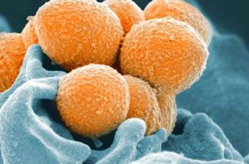 Fransada “Strep A” bakteriyasından 3 NƏFƏR ÖLDÜ