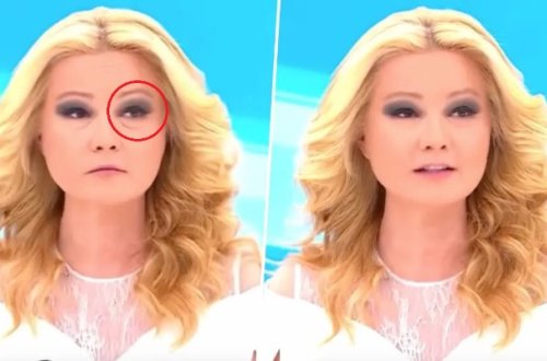 Canlı efirdə üzündəki filtr sürüşdü, reallıq ortaya çıxdı - Video