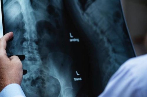 Uşağı kəskin ağrılarla xəstəxanaya apardılar – Müayinə nəticələri həkimləri təəccübləndirdi - FOTO