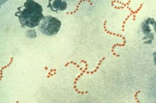 İngiltərədə Strep A-dan ölənlərin sayı 122-yə çatır