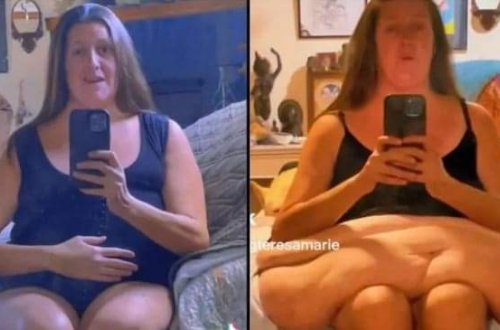 44 yaşlı qadın 5 ildə 190 kilo arıqladı: Hər kəs bu qadından danışır - FOTO