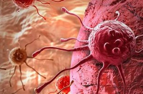 ABŞ-da xərçəngdən ölüm halları son 30 ildə 32 faiz azalıb