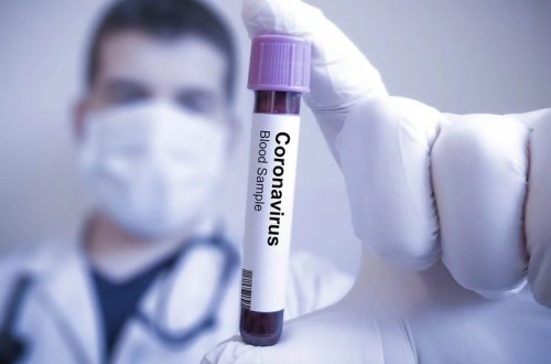 Azərbaycanda koronavirusa 46 yeni yoluxma qeydə alınıb