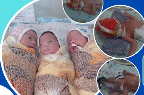 13 il sonsuzluqdan əziyyət çəkən qadının üçəmi oldu - Foto