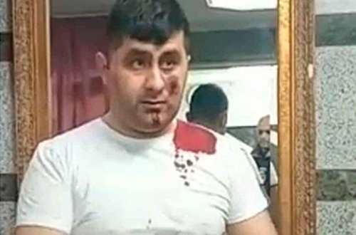 Ötən gün yaralanan Vasif 4 saatlıq əməliyyat keçirdi