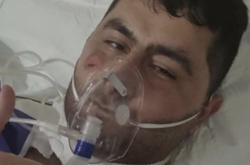 Terrorçunu zərərsizləşdirən Vasifin əməliyyatdan sonrakı FOTOsu