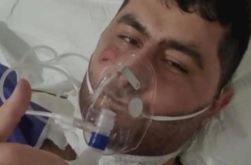 Əməliyyat zamanı Vasifin bədənindən 6 qəlpə çıxarılıbmış