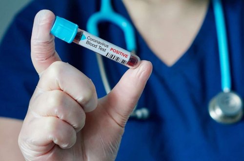 Son sutkada 39 yeni yoluxma faktı qeydə alınıb, 2 nəfər ölüb