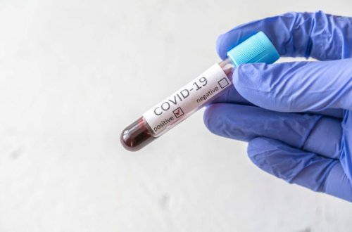 Azərbaycanda daha 28 nəfər koronavirusa yoluxub, 1 nəfər ölüb