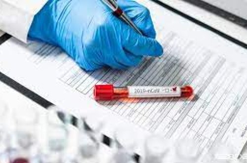 Azərbaycanda koronavirusa 28 yeni yoluxma qeydə alınıb, 3 nəfər ölüb