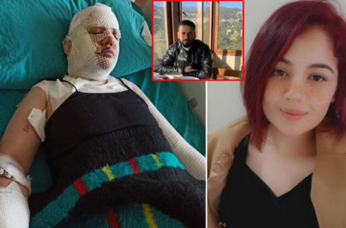 Zəlzələdə evinə sığınan keçmiş arvadının üstünə qaynar su tökən şəxs: “Yeraltı təkanlar səbəb oldu” - FOTO