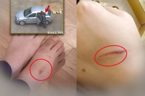 Küçədə qaçırılan qadınla bağlı ŞOK DETALLAR - Gələn gündən şiddət görür - FOTO