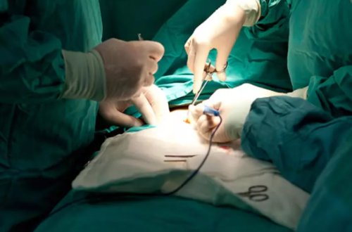 Belə BİABIRÇILIQ OLMAMIŞDI: Həkim səhvən xəstənin cinsi orqanını qopardı