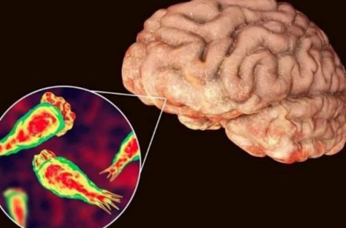 ABŞ-də “beyin yeyən amöb” can aldı - FOTO