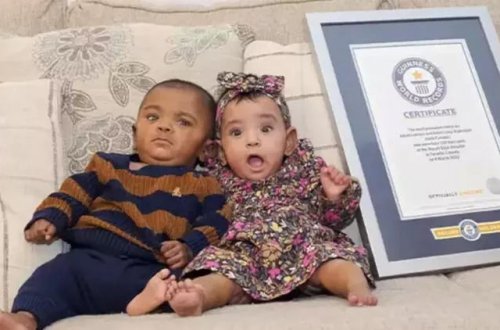 Dünyanın ən erkən doğulan əkizləri Ginnesin Rekordlar Kitabına düşüb