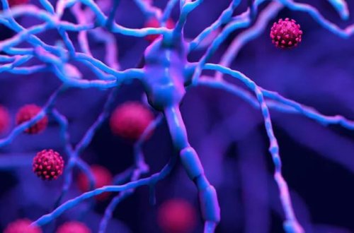 Tanzaniyada Marburq virusundan 5 nəfər ölüb