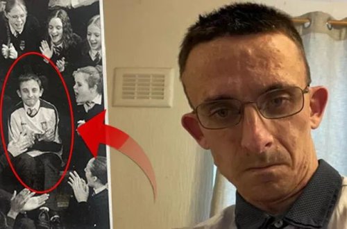 Boyuna görə lağ obyekti olan adam 45 sm böyüyüb