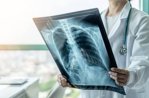 Ötən il 2877 xəstə ilk dəfə vərəmə yoluxub