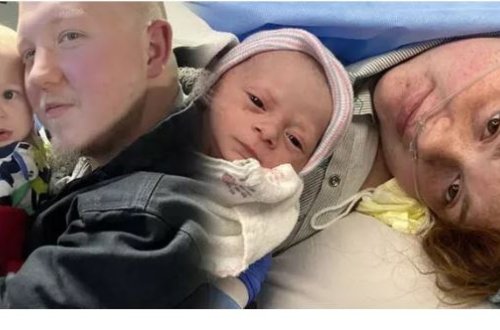 Kəskin ağrı ilə xəstəxanaya gedən qadın həkimləri şoka saldı