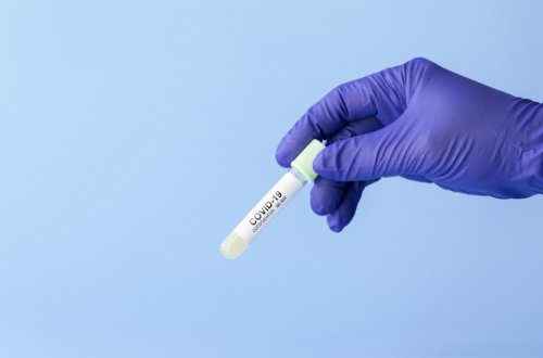 Azərbaycanda daha 64 nəfər koronavirusa yoluxub