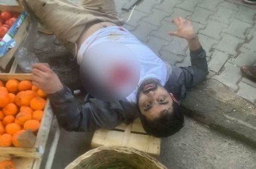 Azərbaycanlı iş adamı Türkiyədə ürəyindən güllələndi - FOTO/VİDEO