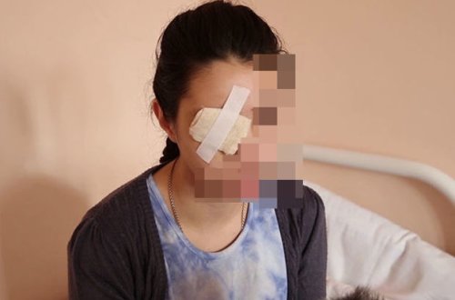 Evə taksi ilə gəldiyi üçün döyülən qadın: “Uşaqlar hər şeyi gördü”