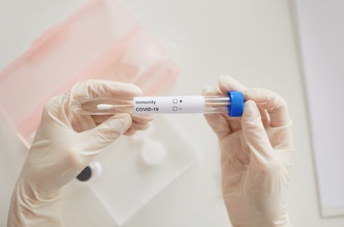 Azərbaycanda son sutkada 48 nəfər koronavirusa yoluxub, 3 nəfər ölüb