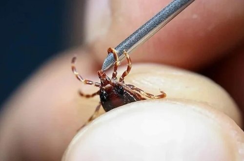 Gənə dişləməsindən müalicə alan şəxs öldü