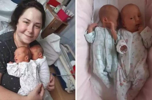 Eyni anda doğulan uşaqlar əkiz deyil - FOTO