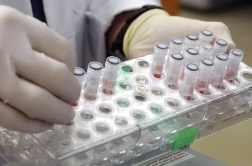 Alimlər süni intellektlə yeni antibiotiklər hazırlayıblar