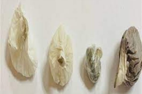 Həbsdə olan qohumuna narkotik gətirən qadın saxlanılıb - FOTO