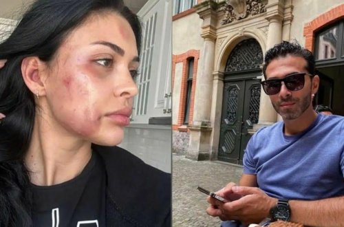 Model sevgilisini döyən Ziya Hüseynzadə cəzalandırıldı