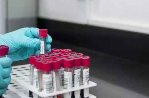 Böyük Britaniyada yoluxucu cinsi xəstəliklər rekord həddə çatıb