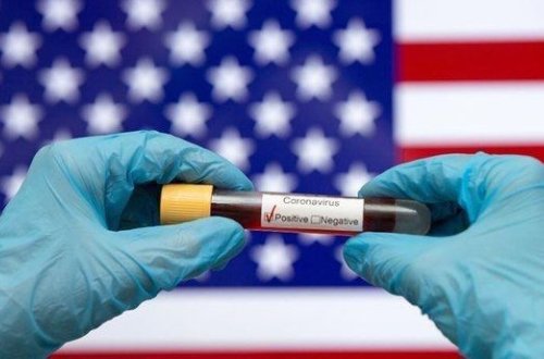 Covid-19 yardım fondundan 280 milyard dollar oğurlanıb