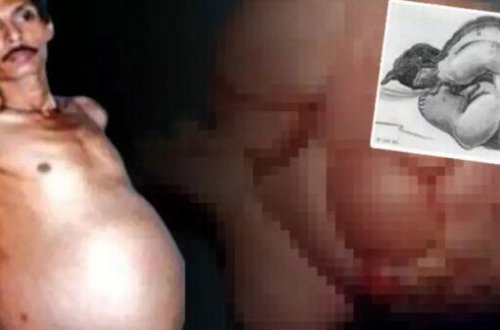 Kişi hamilə qaldı - ŞOK FOTO