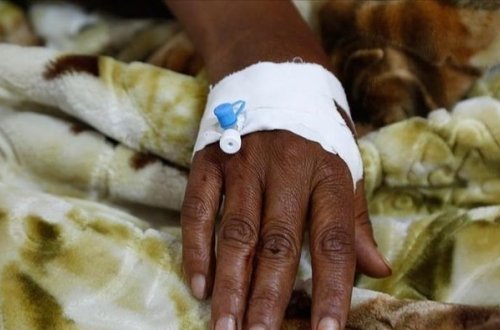 Cənubi Afrikada vəba epidemiyası nəticısində ölənlərin sayı 47-yə yüksəldi
